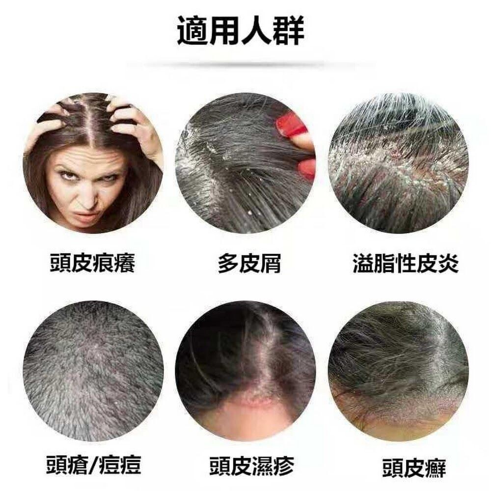 日本進口 Fukemin頭髪淨化洗髪精/潤髪乳/頭皮深層清潔液 #平行輸入-圖片-5