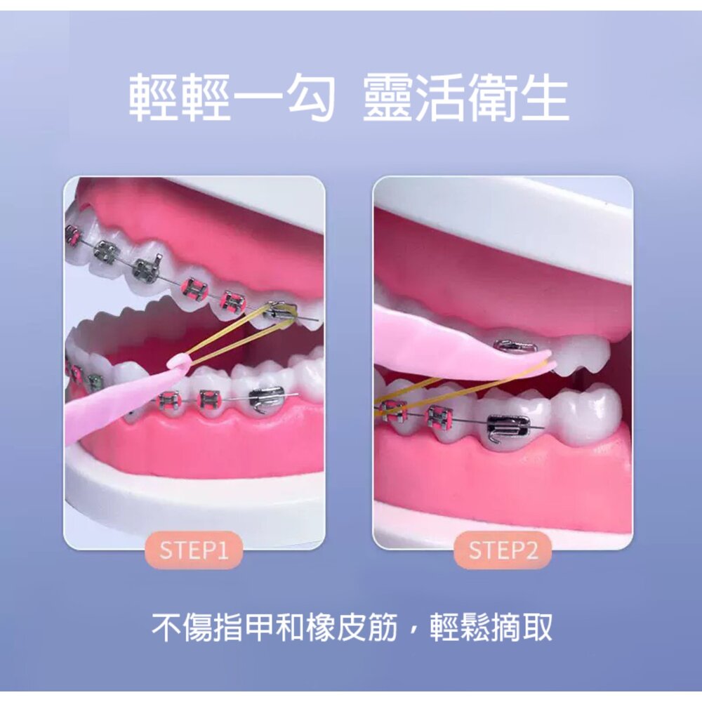 矯正專用 橡皮圈放置鈎一入 掛鈎-圖片-1