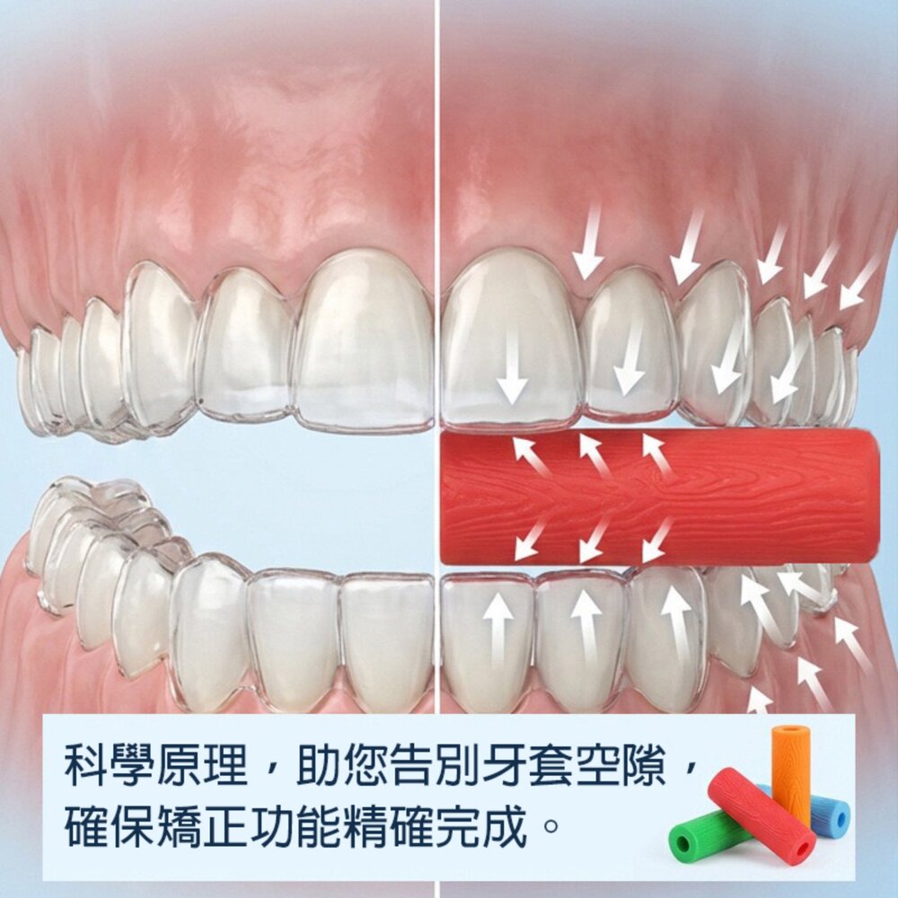 隱形牙套用 矯正專用 咬膠一入(附收納盒)-圖片-2