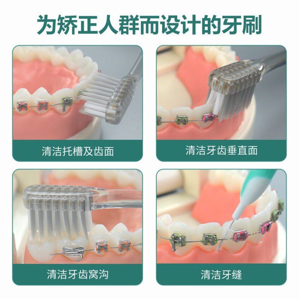SILVER 矯正專用 凹型軟毛抗菌Ag+銀離子矯正牙刷一支-圖片-2