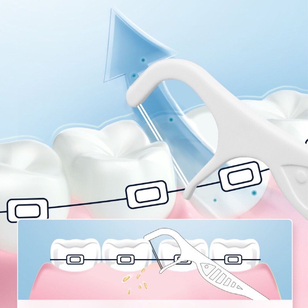 ORTHODONTIC FLOSS PICK 矯正專用牙線棒100支/袋裝 矯正牙線棒-圖片-4
