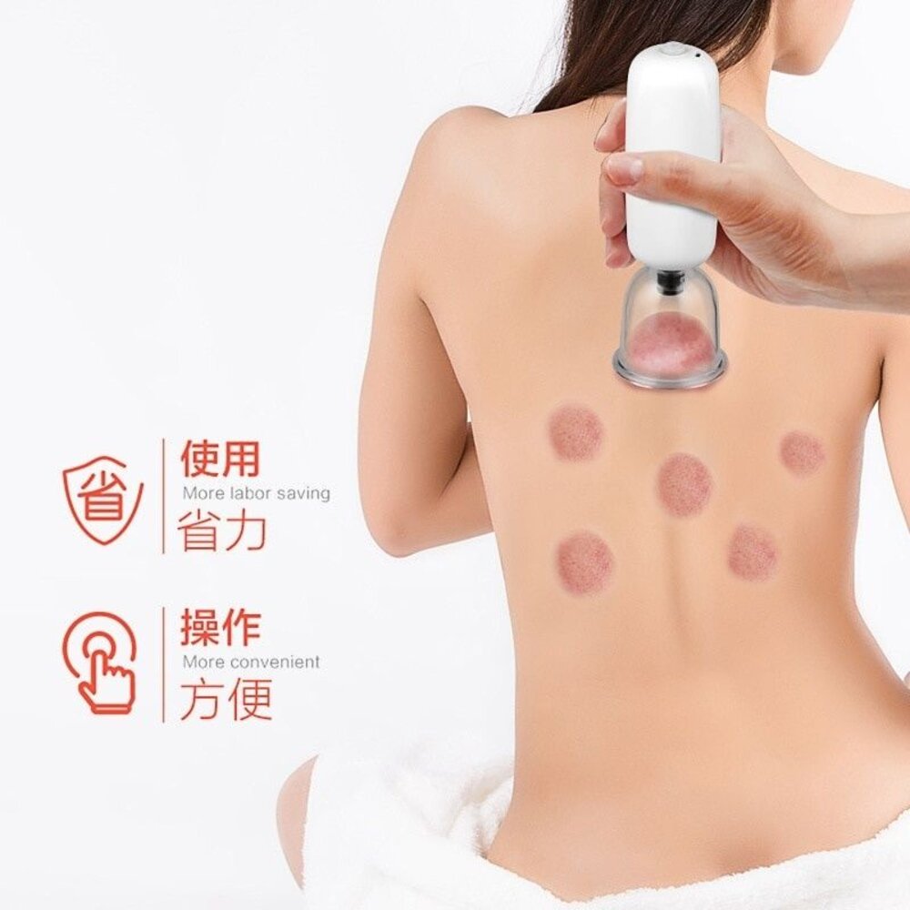 電動拔罐刮痧儀 拔罐儀器 拔罐器 疏通經絡 美容除濕氣神器 鑑賞期 送禮-圖片-2