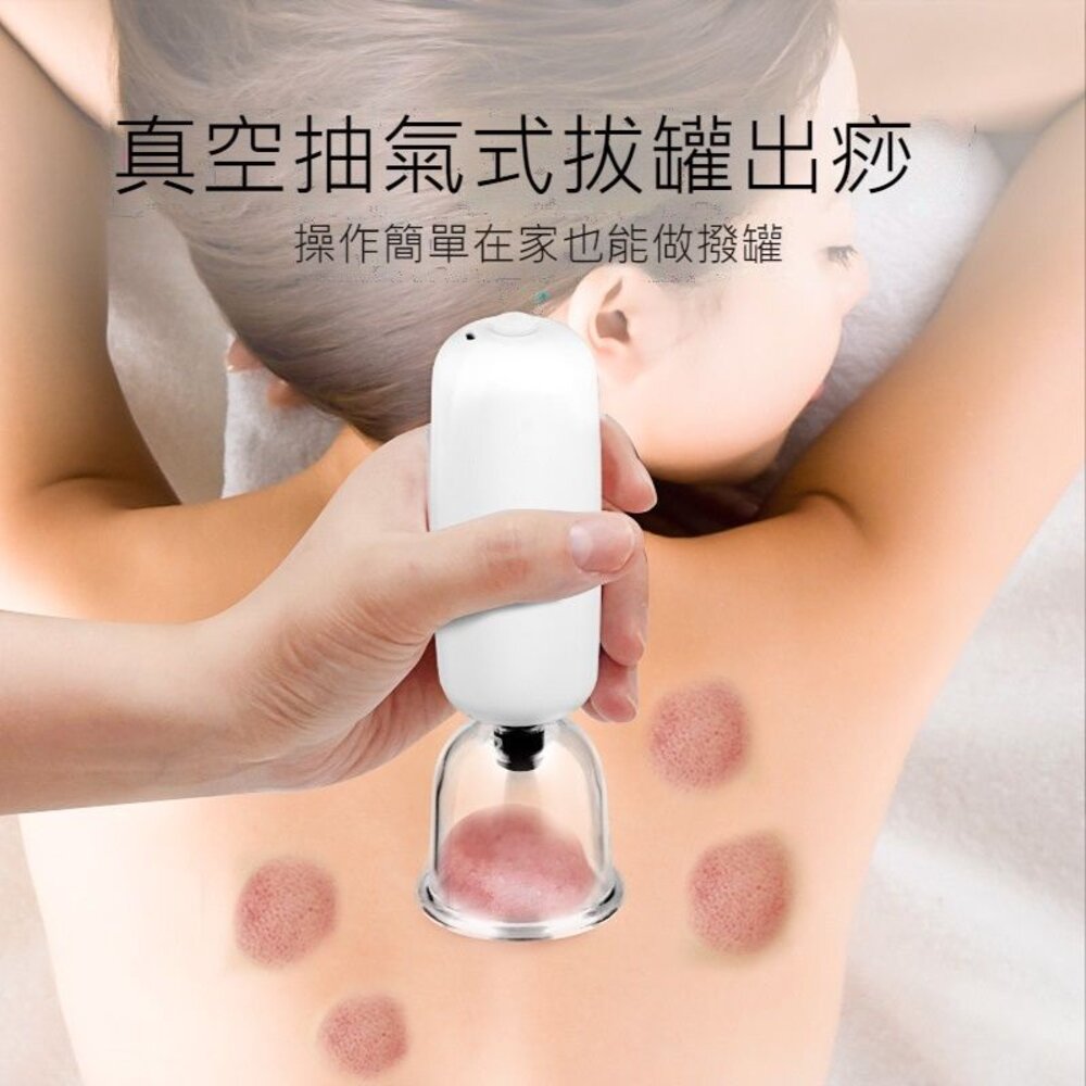220111-00005-電動拔罐刮痧儀 拔罐儀器 拔罐器 疏通經絡 美容除濕氣神器 鑑賞期 送禮